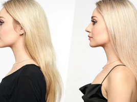 Quick And Easy Ways To Fix Brassy Hair At Home