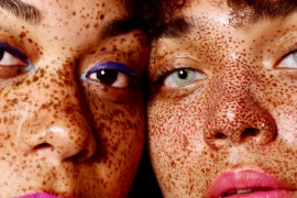 What Is Melanated Skin & How To Take Care of It?
