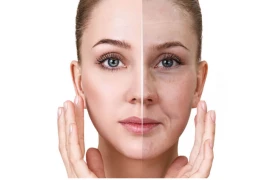 What Is Sallow Skin & How To Treat It?