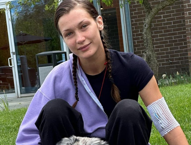 Bella Hadid's Lyme Disease Journey: 15 Years of Invisible Suffering