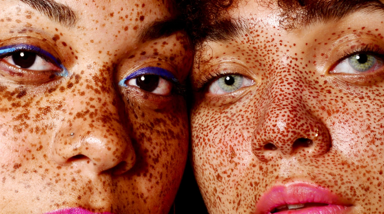 What Is Melanated Skin & How To Take Care of It?