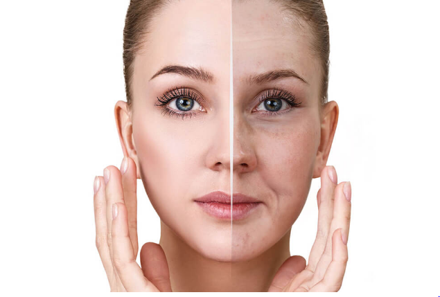 What Is Sallow Skin & How To Treat It?